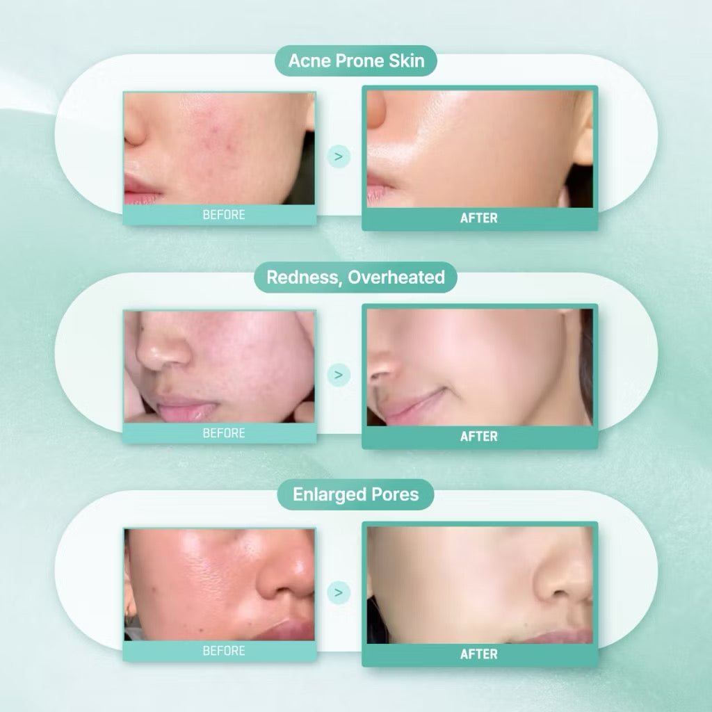 SBM PDRN Skin Booster Set