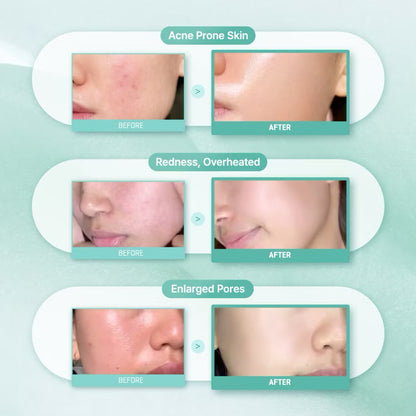 SBM PDRN Skin Booster Set