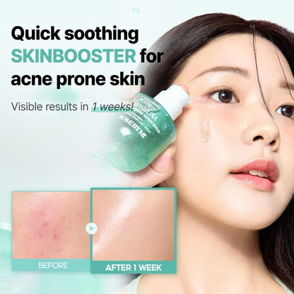 SBM PDRN Skin Booster Set