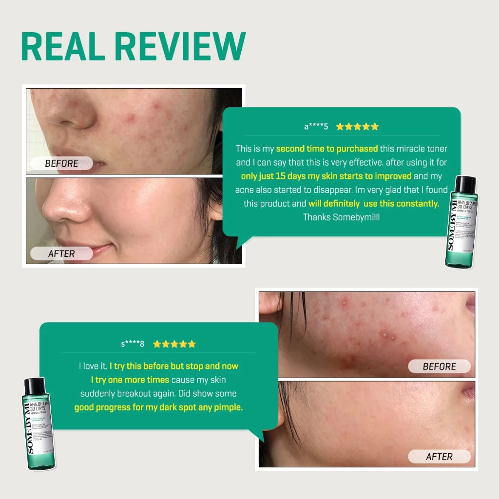 SBM AHA-BHA-PHA 30 Days Miracle Set (Toner+Serum+Cream+Cleansing Bar)