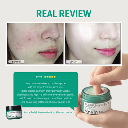 SBM AHA BHA PHA Cica Synergy Acne Care Set (Miracle Serum + Miracle Cream)