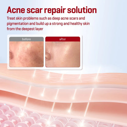 SBM [Bundle of 2] Snail Truecica Miracle Repair Toner 150ml