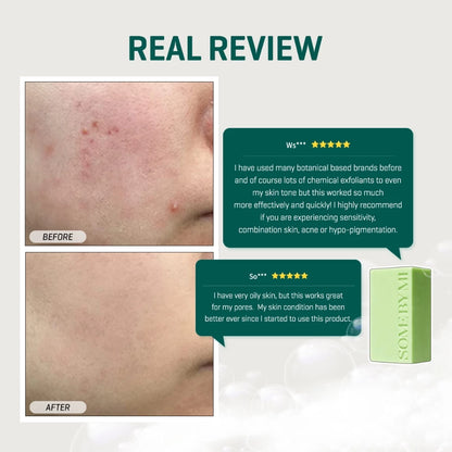 SBM AHA.BHA.PHA 30 Days Miracle Cleansing Bar / Soap / Facial Cleanser