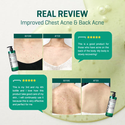 SBM Body Acne Clear Away AHA-BHA-PHA 30 Days Miracle Acne Clear Body Cleanser 400g