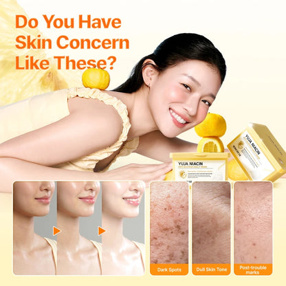SBM Yuja Niacin Daily Care Set (Anti-Blemish Daily Mask 30 sheets + Yuja Serum 50ml)