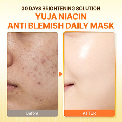 SBM 7 Days Brightening Booster Duo (Yuja Niacin Daily Mask + Serum Mist SET [30ea + 80ml set]