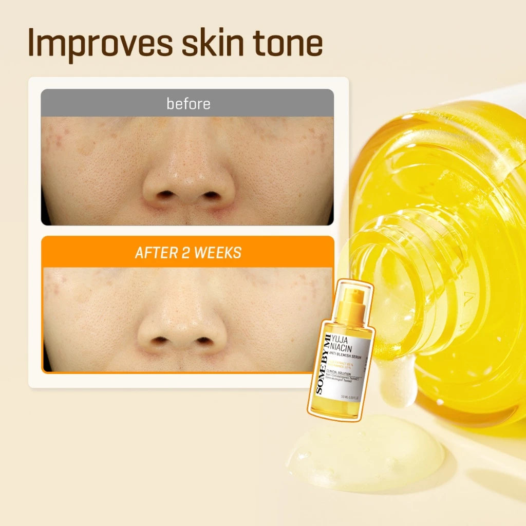 SBM Yuja Niacin 30 Days Blemish Care (Serum 50ml+ Niacin Anti Blemish Cream 60g)