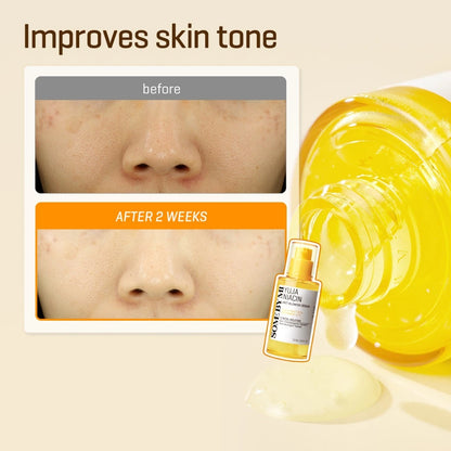 SBM Yuja Niacin 30 Days Blemish Care Serum 50ml+ Toner 150ml