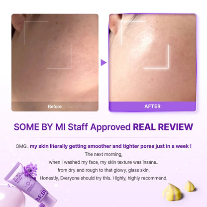 SBM Retinol Glass Skin 2 Step Set (Retinol Bakuchiol Bubble Toner100ml+Retinol Bakuchiol Dual Cream 50ml)